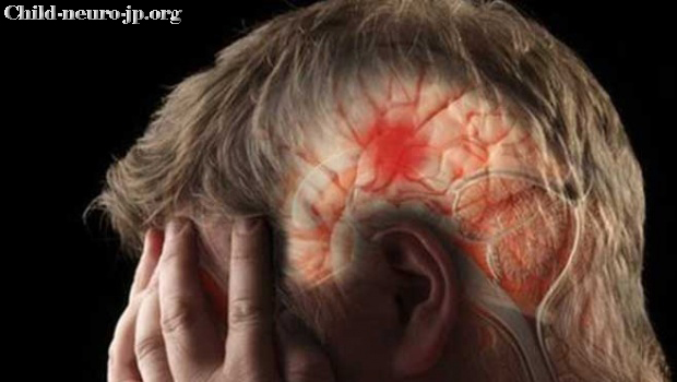 Mengenal Plastisitas Otak Yang Mengacu Saraf Otak Anak